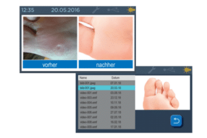 Hadewe Medeas Plus - podologistic 09
